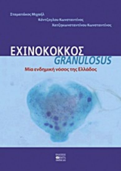 Εικόνα Εχινόκοκκος Granulosus