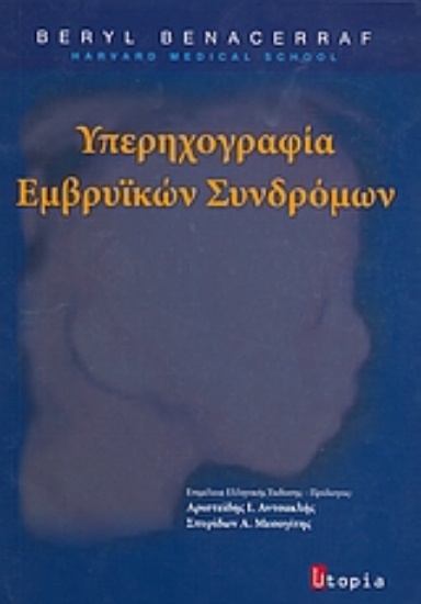 Εικόνα Υπερηχογραφία εμβρυϊκών συνδρόμων
