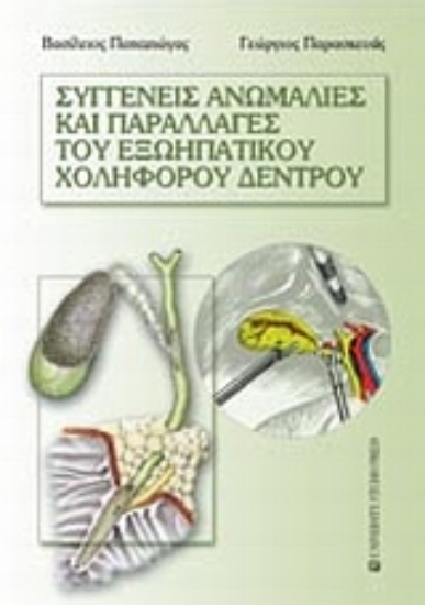 Εικόνα Συγγενείς ανωμαλίες και παραλλαγές του εξωηπατικού χοληφόρου δένδρου