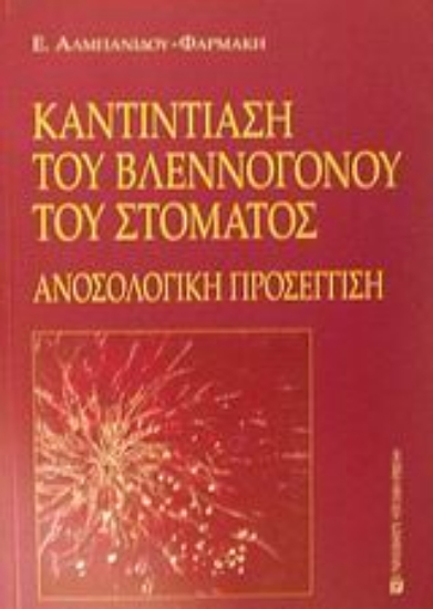 Εικόνα Καντιντίαση του βλεννογόνου του στόματος