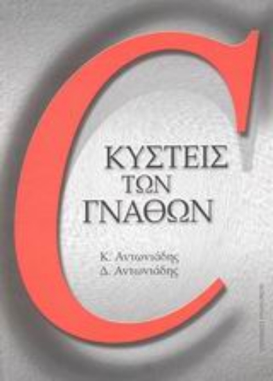 Εικόνα Κύστεις των γνάθων