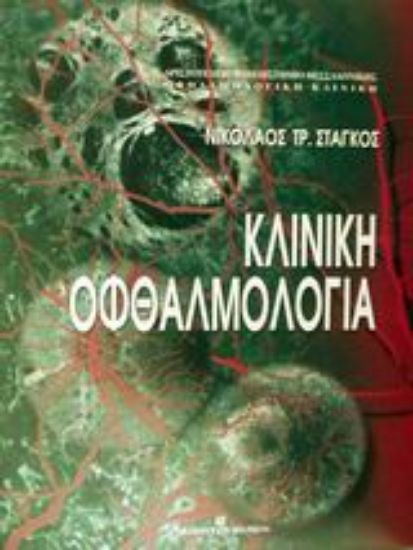 Εικόνα Κλινική οφθαλμολογία