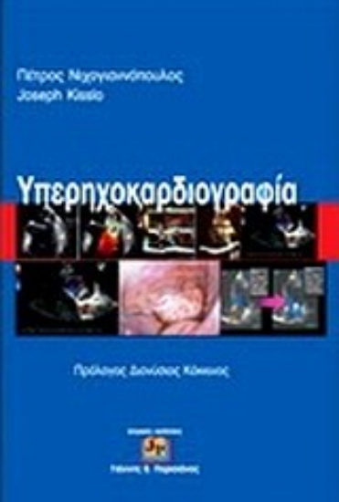 Εικόνα Υπερηχοκαρδιογραφία