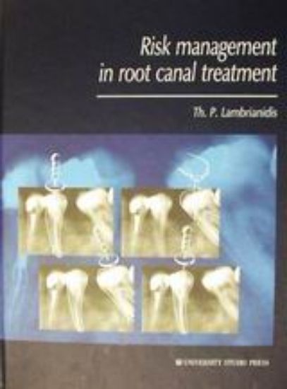 Εικόνα Risk Management in Root Canal Treatment
