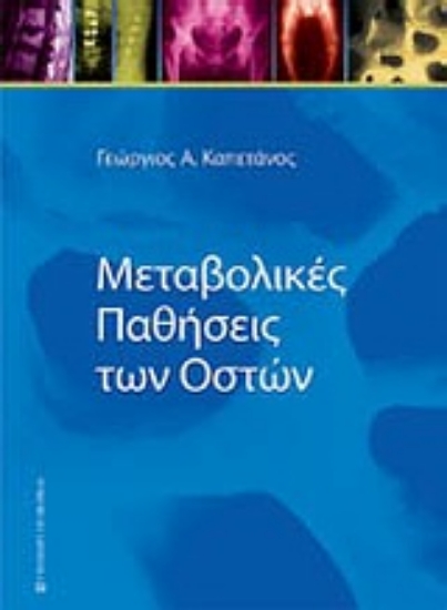 Εικόνα Μεταβολικές παθήσεις των οστών