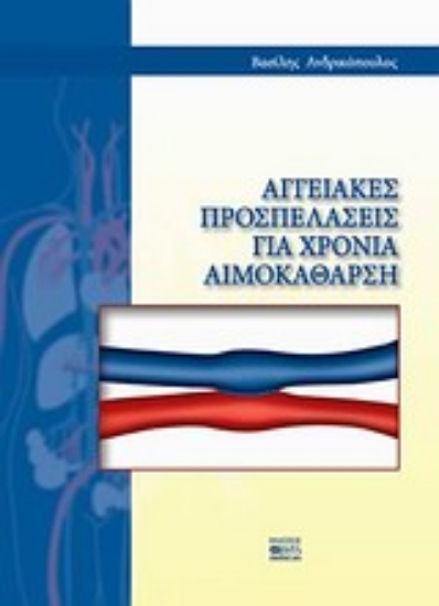 Εικόνα Αγγειακές προσπελάσεις για χρόνια αιμοκάθαρση