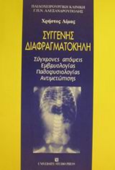 Εικόνα Συγγενής διαφραγματοκήλη