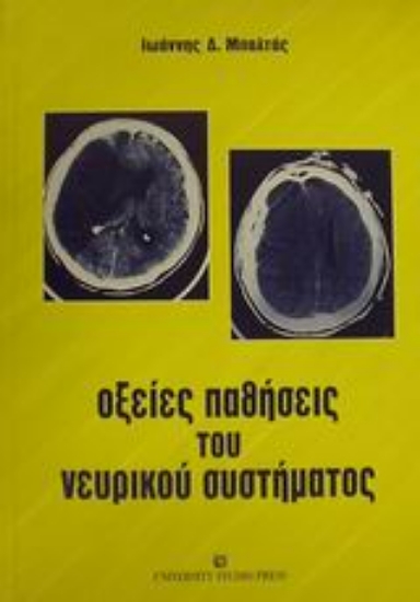Εικόνα Οξείες παθήσεις του νευρικού συστήματος