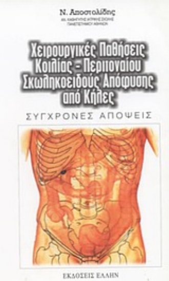 Εικόνα Χειρουργικές παθήσεις κοιλίας, περιτοναίου, σκωληκοειδούς απόφυσης, από κήλες