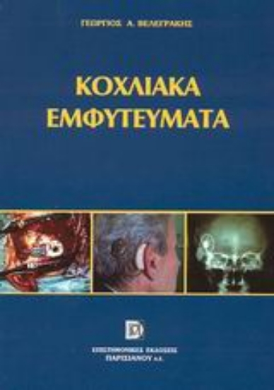 Εικόνα Κοχλιακά εμφυτεύματα