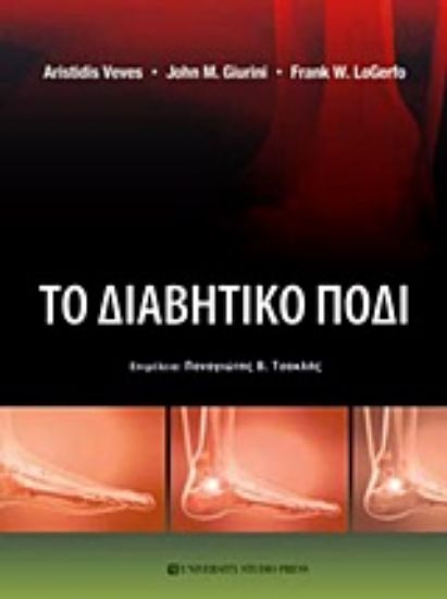 Εικόνα Το διαβητικό πόδι