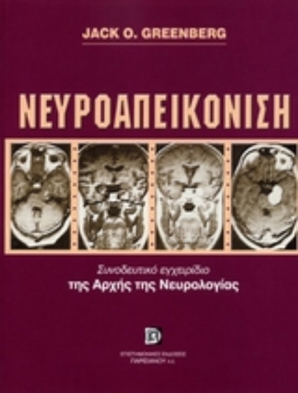 Εικόνα Νευροαπεικόνιση