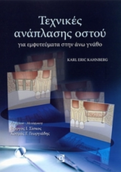 Εικόνα Τεχνικές ανάπλασης ιστού