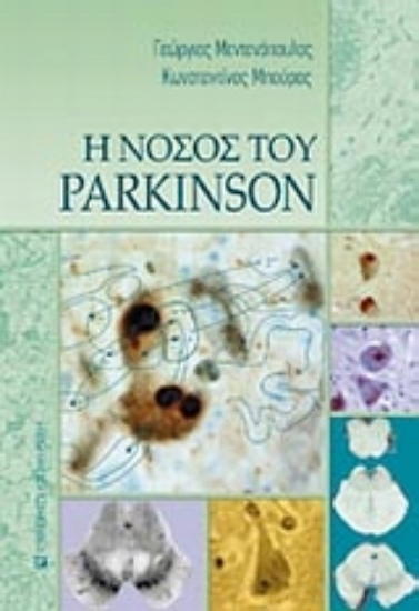 Εικόνα Η νόσος του Parkinson