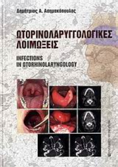 Εικόνα Ωτορινολαρυγγολογικές λοιμώξεις