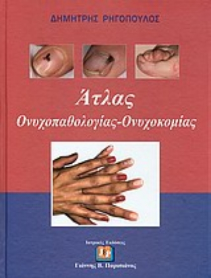 Εικόνα Άτλας ονυχοπαθολογίας - ονυχοκομίας