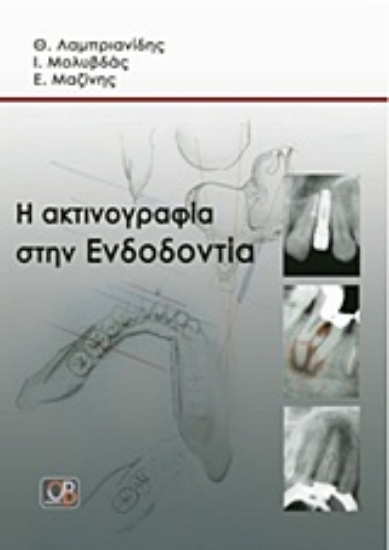 Εικόνα Η ακτινογραφία στην ενδοδοντία