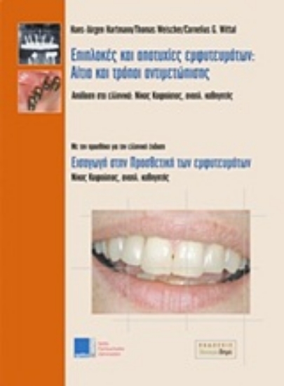 Εικόνα Επιπλοκές και αποτυχίες εμφυτευμάτων