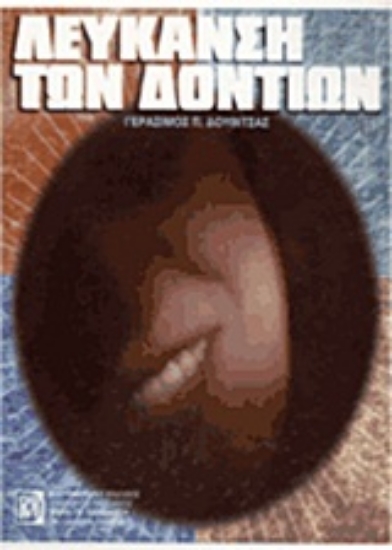 Εικόνα Λεύκανση των δοντιών