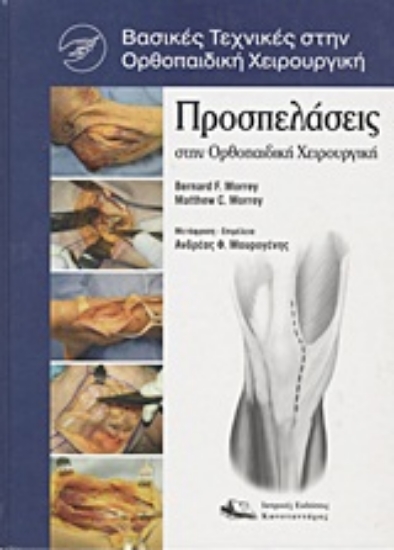 Εικόνα Προσπελάσεις στην ορθοπαιδική χειρουργική