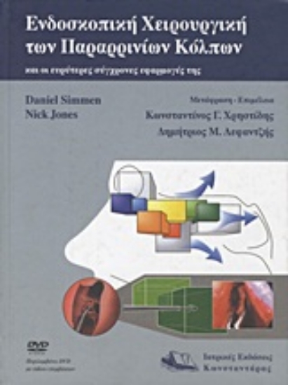 Εικόνα Ενδοσκοπική χειρουργική των παραρρινίων κόλπων