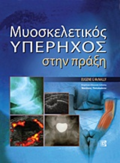 Εικόνα Υπερηχογραφική απεικόνιση του μυοσκελετικού συστήματος Πρακτικός οδηγός