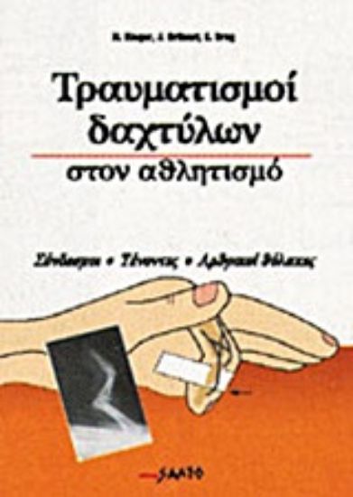 Εικόνα Τραυματισμοί δακτύλων στον αθλητισμό