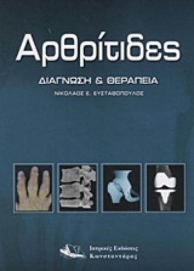 Εικόνα Αρθρίτιδες