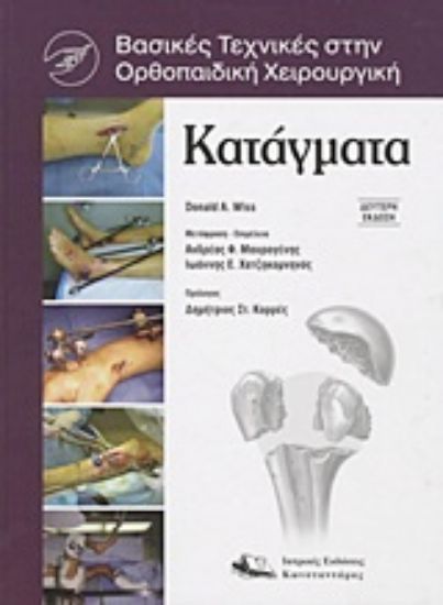 Εικόνα Κατάγματα