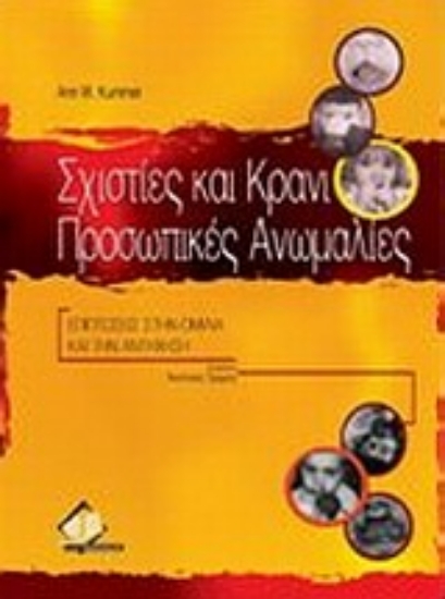 Εικόνα Σχιστίες και κρανιοπροσωπικές ανωμαλίες
