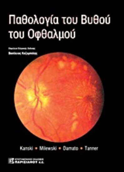 Εικόνα Παθολογία του βυθού του οφθαλμού