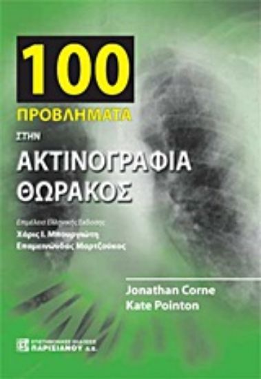 Εικόνα 100 προβλήματα στην ακτινογραφία θώρακος