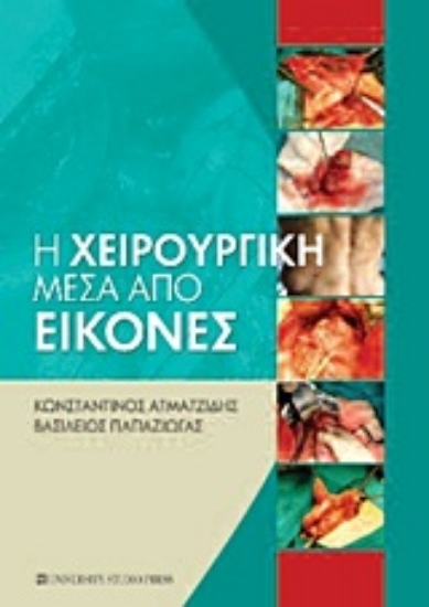 Εικόνα Η χειρουργική μέσα από εικόνες