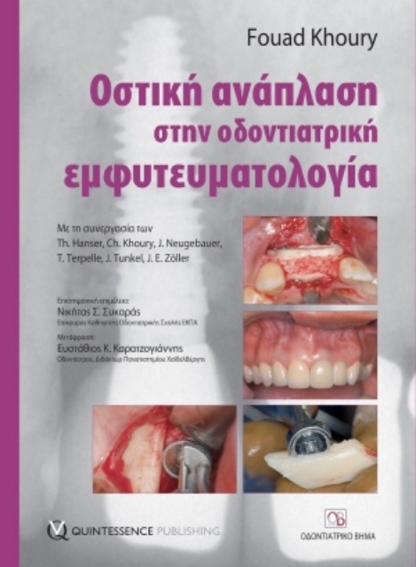 254695-Οστική ανάπλαση στην οδοντιατρική εμφυτευματολογία