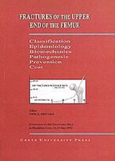 102279-Fractures of the Upper End of the Femur
