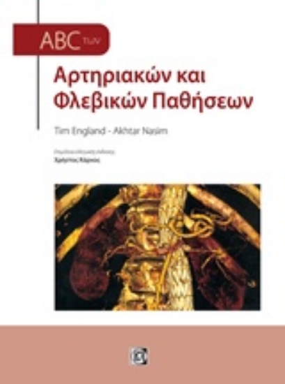 233844-ABC των αρτηριακών και φλεβικών παθήσεων