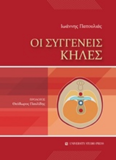 229758-Οι συγγενείς κήλες