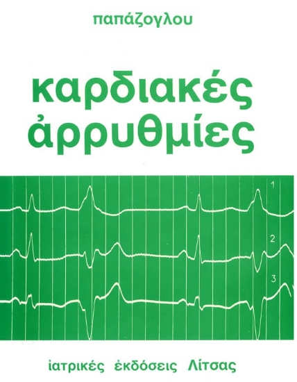 Καρδιακές αρρυθμίες