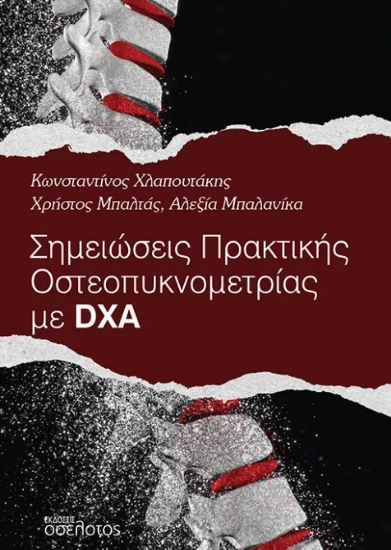 303161-Σημειώσεις πρακτικής οστεοπυκνομετρίας με DXA