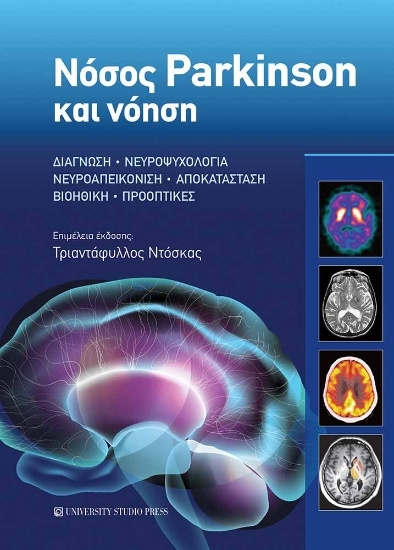 303672-Νόσος Parkinson και νόηση