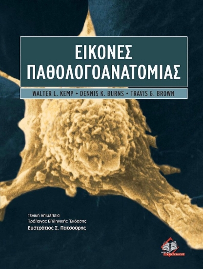 Εικόνα Εικόνες παθολογοανατομίας