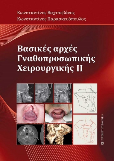 308235-Βασικές αρχές γναθοπροσωπικής χειρουργικής IΙ